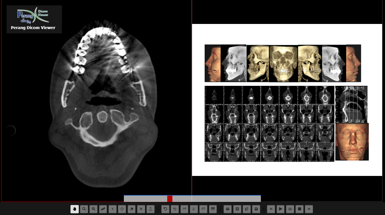 مشاهده و بازسازی سه‌بعدی تصاویر CBCT در Perang Dicom Viewer