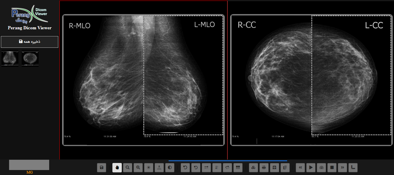 Perang Dicom Viewer