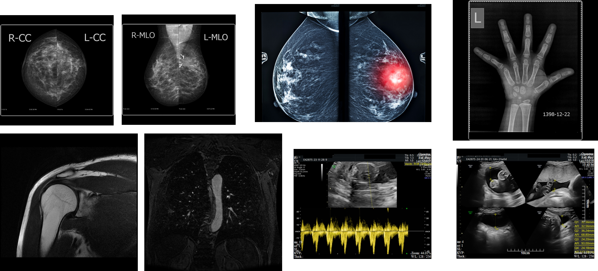 مشاهده تصاویر CT و MRI در Viewer تخصصی پرنگ
